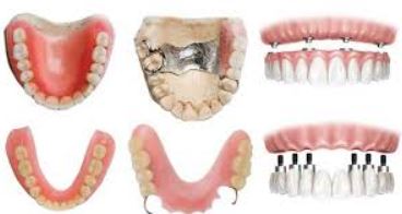 stellite dentaire